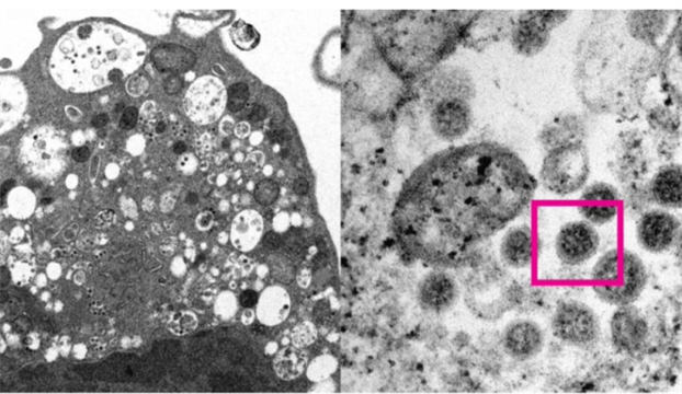 科学家详解打疫苗后感染几率到底有多大